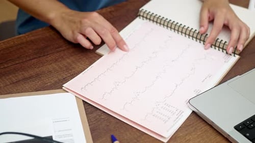 Cardiologist Looks at Cardiogram Working with Results of Patient Examination Sitting in Office