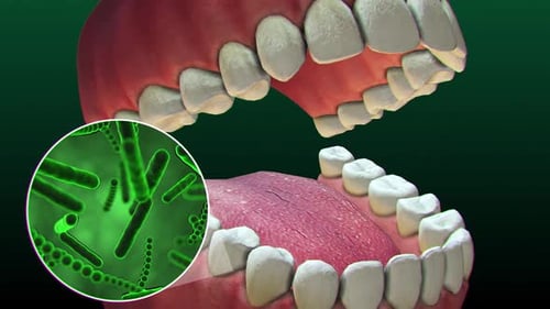 Bacterias and viruses around tooth