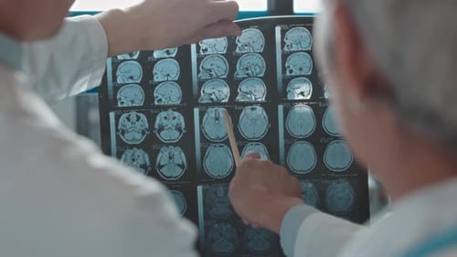 Medical Professionals Analyzing Brain Scan in Clinic