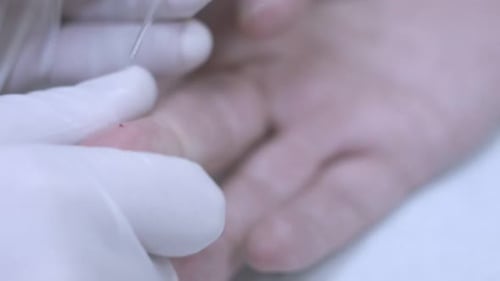 Taking Blood Sample From Finger. Close Up of Hands in Glove Draw
