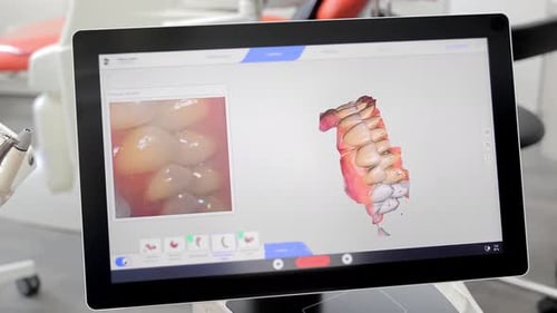 3D Scanning of Teeth Looking at the Screen and Scanning the Dental Jaw in 3D Space Modern Dentistry