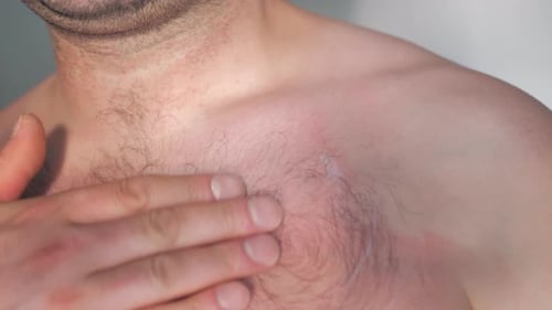 Man Applying Lotion to Upper Chest Close Up