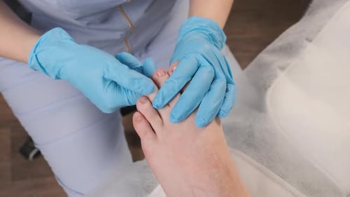 Podiatrist Treats Patient's Toenails in Clinic Close Up
