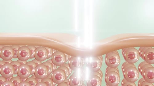 Skin cells with collagen and light beam on surface