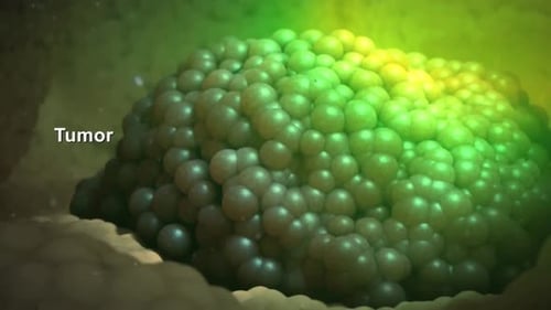 Animated Tumor Cells Undergoing Change