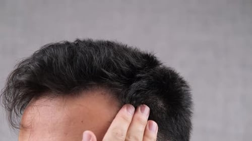 Man Checking Hair Loss