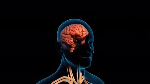 Medical 3D Animation of Aneurysm Burst and Artery Plaque