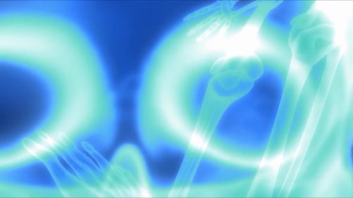 high quality x-ray collection body part and fracture area