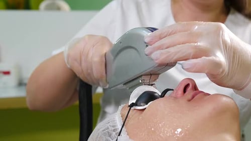 Woman Receiving Laser Facial Treatment in Clinic