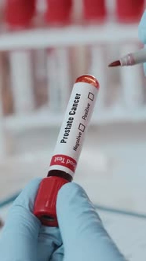 Marking a Prostate Cancer Test as Negative