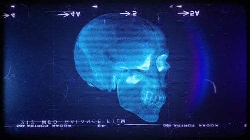 Skull X Ray