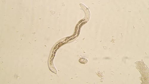 Ansteckungssammlung: Isolierter mikroskopischer Wurm, der über einen hellen Hintergrund kriecht