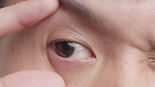 Young Asian man opening his brown eye and looking at it. Close up