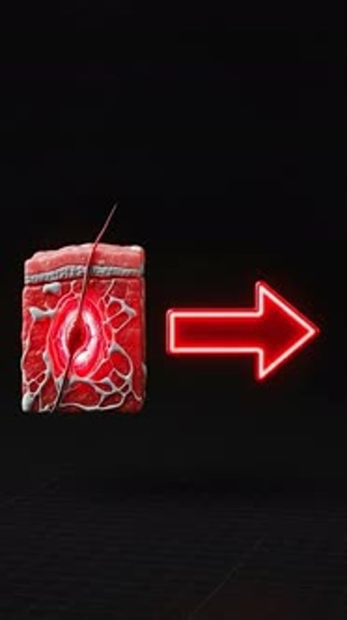 Animated Skin Tissue Healing Process Before After Comparison