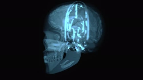 Futuristic Medical X-Ray Scan of Human Skull Brain