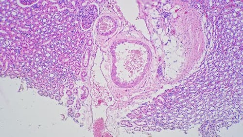 Artery and Vein in Section Magnified Under Microscope 100x Filmed on Bright Field