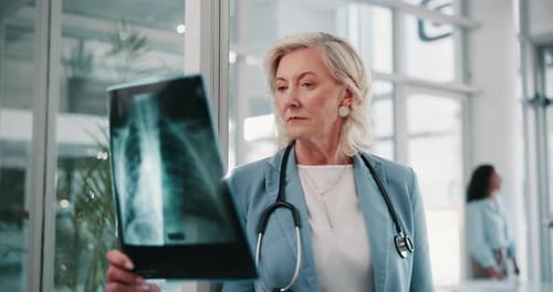 Mature woman, doctor or exam with x ray for CT scan, test or medical results at hospital