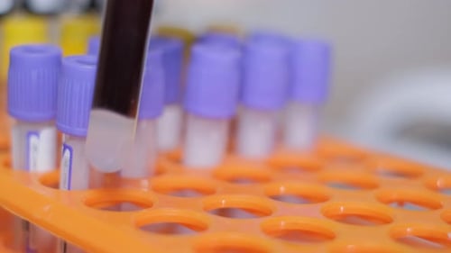 Blood Samples in Test Tubes in Lab Setting
