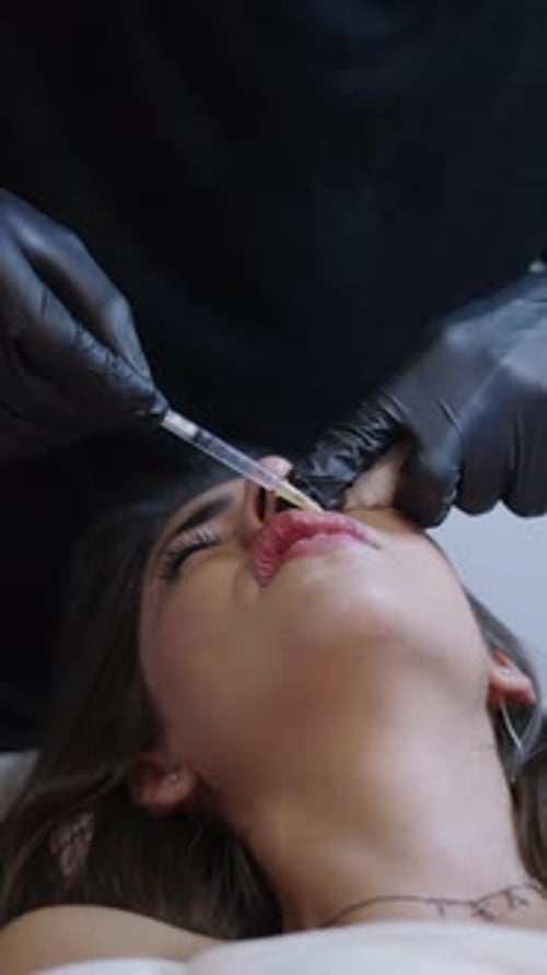 El médico limpia el área de los labios después de la inyección