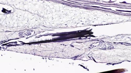 Skin Section Through Hair Follicle Filmed Under Microscope 100x on Bright Field Background