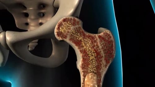 Detailed Medical Animation of Human Hip Bone and Femur with Bone Marrow