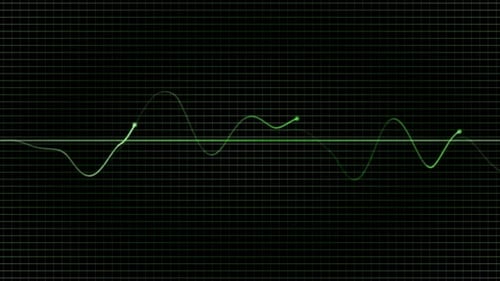 Vital Pulse Graph – Medical Monitor Animation
