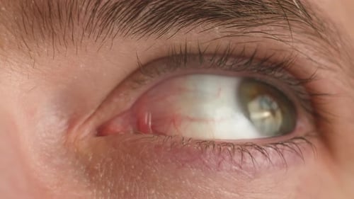 Close Up Eye Moves Sides Ill Eyeball Moving Upside and Left to Right Macro View