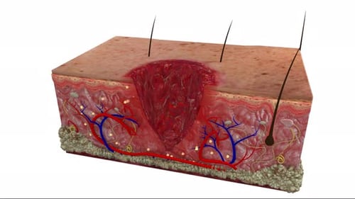 3D Animation of Skin Healing and Regeneration Process
