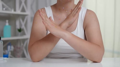 Medium Shot Unrecognizable Young Caucasian Woman with Monkey Pox Rash Crossing Hands in Slow Motion