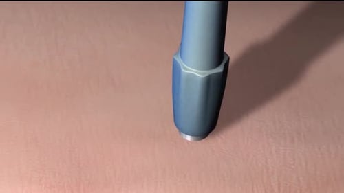 Close-up of blue medical device on skin