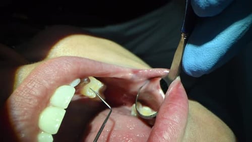 Dental Care Extreme Close Up Macro Video Dentist Treat Patient Teeth Orthodontist Works with