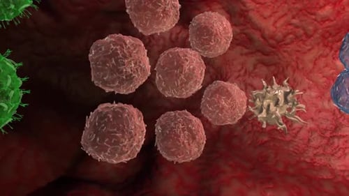 Detailed medical illustration showing a white blood cell actively attacking and destroying