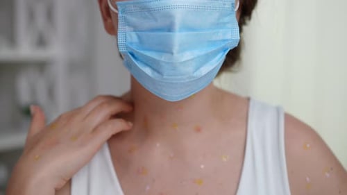 Adult with Rash Wearing Mask Close Up