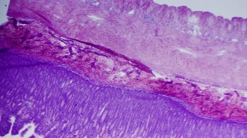 large intestine transverse section