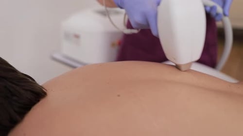 A Modern Approach to Skin Therapy That Includes Advanced Laser Technology Especially on the Back