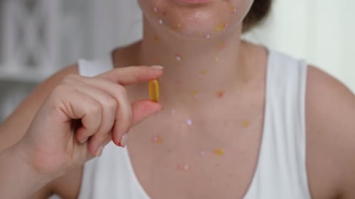 Young Adult Holds Capsule for Skin Condition