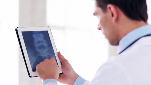 Man Examining X-Ray on Tablet in Modern Office