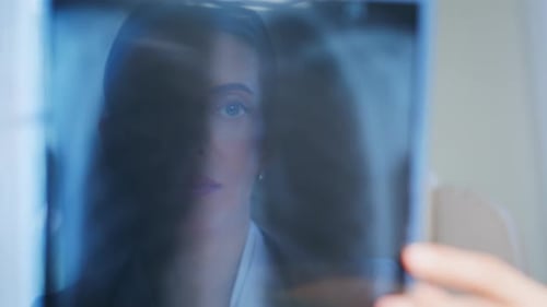 Medical Professional Examines Chest X-Ray in Hospital