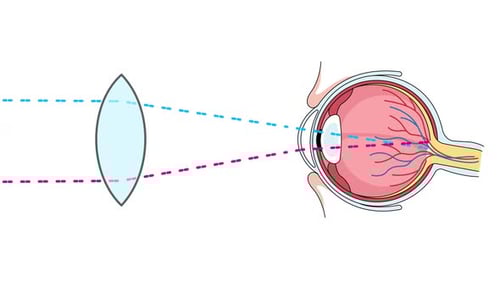 convex lens eye focusing light on retina accommodation vision science animation