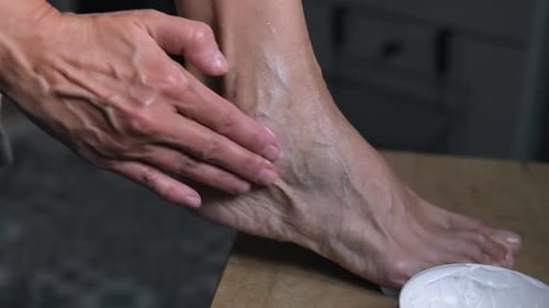 A Mature Woman is Taking Care of Her Legs Rubs Beautiful Foot with Veins Cream Foot Care Venous