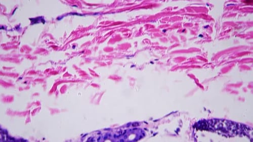 Microscopic 400x View of Human Skin with Shown Sweat Glands Against Bright Field