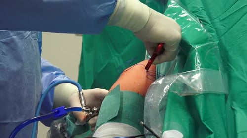 Knee Arthroscopy Surgery in Operating Room