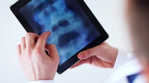 Doctor Analyzes X-Ray Image on Tablet Computer