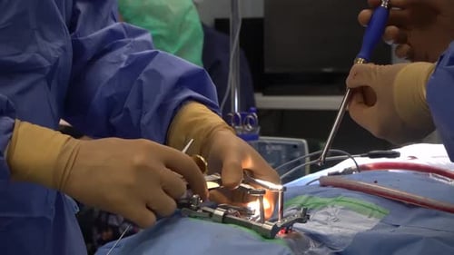 Chirurgie de la colonne vertébrale ou cages intercorporelles pour la fusion de la colonne vertébrale