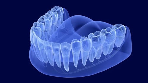 Teeth root anatomy, Xray view.