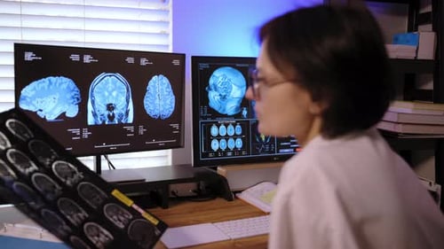 A Patient MRI Scan is Analyzed By Doctors to Diagnose Brain Conditions Medical Hospital