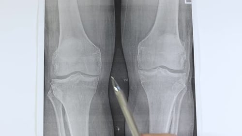Doctor learn X-ray