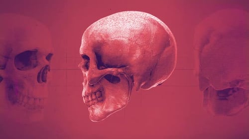 Medical Chart Skull 03