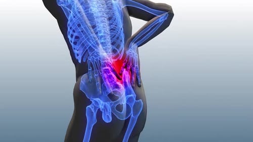 Human Body Skeleton with Lower Back Pain Medical Visualization