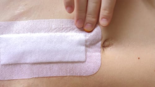 Abdomen of Young Girl Closeup Video of Girl's Hand is Changing Bandage After the Abdominal Surgery